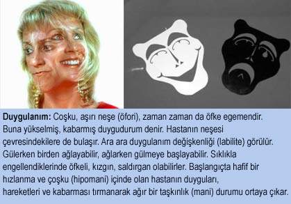 MANİK DEPRESYONDA KLİNİK ÖZELLİKLER 13