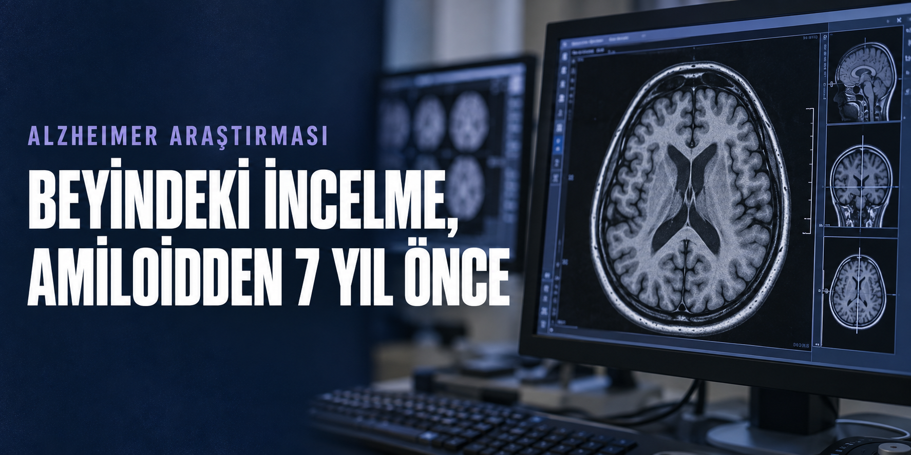 Alzheimer İzleri Plaklardan 7 Yıl Önce Bulundu